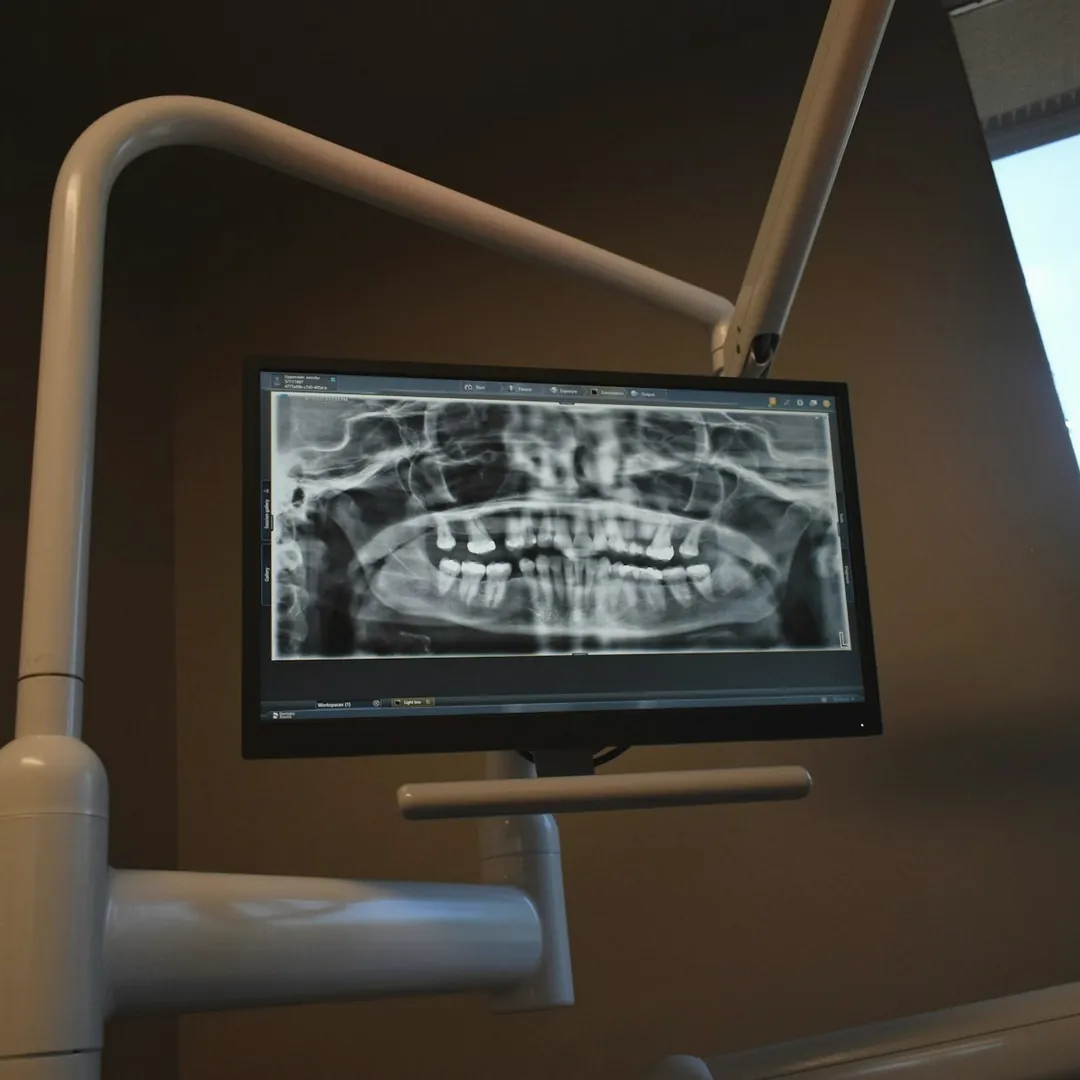 Radiografía panorámica en la pantalla de un consultorio dental.