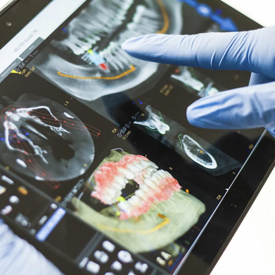 Mano con guante señalando imágenes dentales en una tablet.